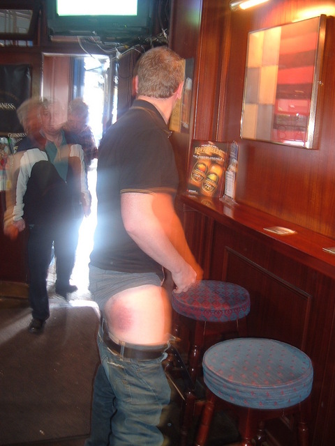 The Bruise of 06